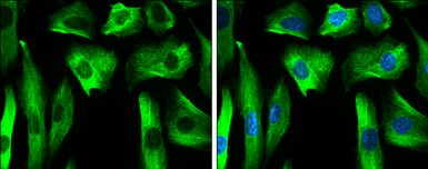 Anti-Nestin antibody [GT935] used in Immunocytochemistry/ Immunofluorescence (ICC/IF). GTX630202