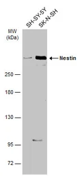 Anti-Nestin antibody [GT935] used in Western Blot (WB). GTX630202