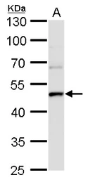 Anti-UQCRC1 antibody [GT1311] used in Western Blot (WB). GTX630393