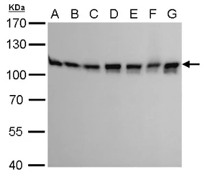 Anti-CSE1L antibody [GT5111] used in Western Blot (WB). GTX630394