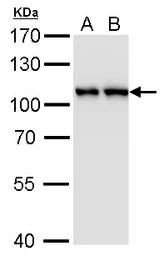 Anti-CSE1L antibody [GT5111] used in Western Blot (WB). GTX630394