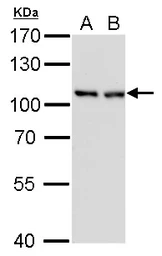 Anti-CSE1L antibody [GT729] used in Western Blot (WB). GTX630395