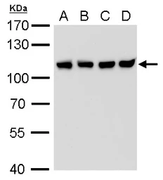 Anti-CSE1L antibody [GT729] used in Western Blot (WB). GTX630395