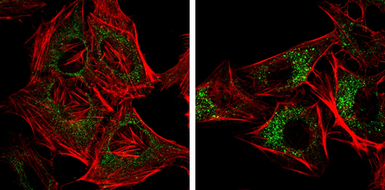 Anti-NDP52 antibody [GT422] used in Immunocytochemistry/ Immunofluorescence (ICC/IF). GTX630396