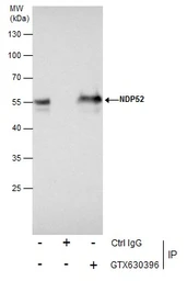 Anti-NDP52 antibody [GT422] used in Immunoprecipitation (IP). GTX630396