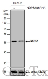 Anti-NDP52 antibody [GT422] used in Western Blot (WB). GTX630396