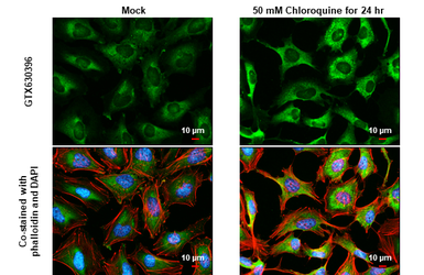 Anti-NDP52 antibody [GT422] used in Immunocytochemistry/ Immunofluorescence (ICC/IF). GTX630396