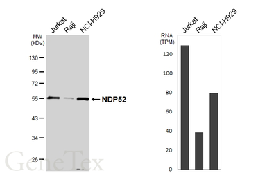 Anti-NDP52 antibody [GT422] used in Western Blot (WB). GTX630396