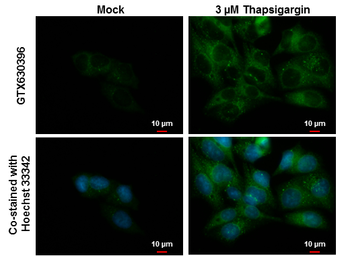 Anti-NDP52 antibody [GT422] used in Immunocytochemistry/ Immunofluorescence (ICC/IF). GTX630396