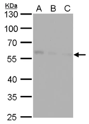 Anti-NDP52 antibody [GT422] used in Western Blot (WB). GTX630396