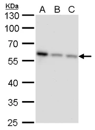 Anti-NDP52 antibody [GT422] used in Western Blot (WB). GTX630396