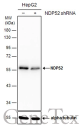 Anti-NDP52 antibody [GT1813] used in Western Blot (WB). GTX630397