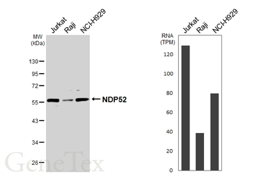 Anti-NDP52 antibody [GT1813] used in Western Blot (WB). GTX630397