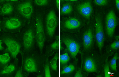 Anti-MEK2 antibody [GT3522] used in Immunocytochemistry/ Immunofluorescence (ICC/IF). GTX630543
