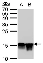 Anti-Histone H4K20me2 (dimethyl Lys20) antibody [GT282] used in Western Blot (WB). GTX630544