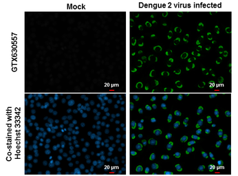 Anti-Dengue virus NS1 protein antibody [GT1061] used in Immunocytochemistry/ Immunofluorescence (ICC/IF). GTX630557