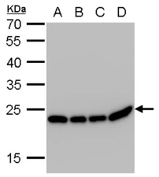 Anti-SOD2 antibody [GT17112] used in Western Blot (WB). GTX630560