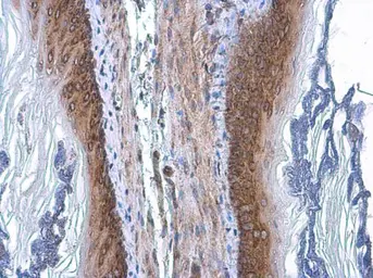 Anti-COPD antibody [GT189] used in IHC (Paraffin sections) (IHC-P). GTX630561