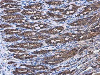 Anti-COPD antibody [GT189] used in IHC (Paraffin sections) (IHC-P). GTX630561