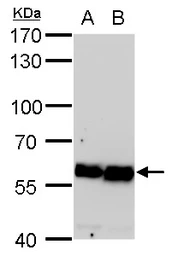 Anti-COPD antibody [GT189] used in Western Blot (WB). GTX630561