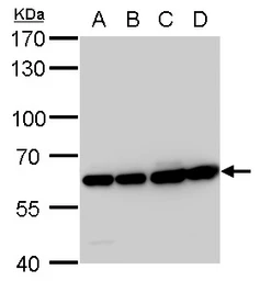 Anti-COPD antibody [GT189] used in Western Blot (WB). GTX630561