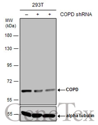 Anti-COPD antibody [GT1318] used in Western Blot (WB). GTX630562