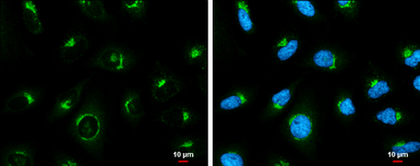 Anti-COPD antibody [GT1318] used in Immunocytochemistry/ Immunofluorescence (ICC/IF). GTX630562