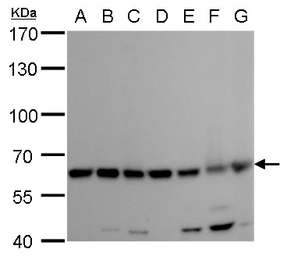 Anti-COPD antibody [GT1318] used in Western Blot (WB). GTX630562