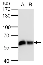 Anti-COPD antibody [GT1318] used in Western Blot (WB). GTX630562