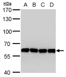 Anti-COPD antibody [GT1318] used in Western Blot (WB). GTX630562