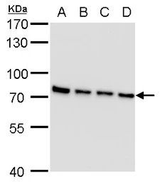 Anti-SLU7 antibody [GT262] used in Western Blot (WB). GTX630652
