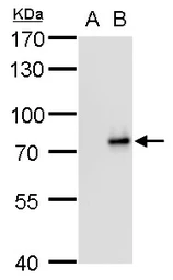 Anti-SLU7 antibody [GT759] used in Western Blot (WB). GTX630653