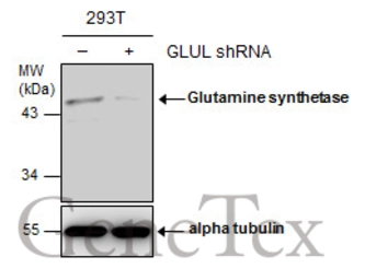 Anti-Glutamine synthetase antibody [GT7711] used in Western Blot (WB). GTX630657