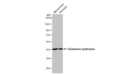 Anti-Glutamine synthetase antibody [GT7711] used in Western Blot (WB). GTX630657