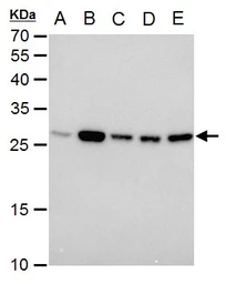 Anti-Triosephosphate isomerase antibody [GT1111] used in Western Blot (WB). GTX630778