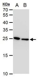 Anti-Triosephosphate isomerase antibody [GT1111] used in Western Blot (WB). GTX630778