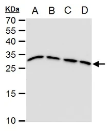 Anti-Triosephosphate isomerase antibody [GT1111] used in Western Blot (WB). GTX630778