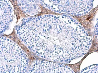Anti-Triosephosphate isomerase antibody [GT3711] used in IHC (Paraffin sections) (IHC-P). GTX630780