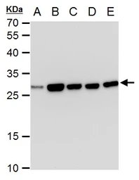 Anti-Triosephosphate isomerase antibody [GT3711] used in Western Blot (WB). GTX630780