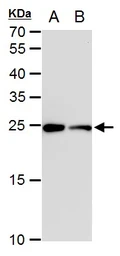 Anti-Triosephosphate isomerase antibody [GT3711] used in Western Blot (WB). GTX630780