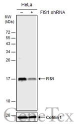 Anti-FIS1 antibody [GT12112] used in Western Blot (WB). GTX630992