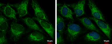Anti-FIS1 antibody [GT12112] used in Immunocytochemistry/ Immunofluorescence (ICC/IF). GTX630992
