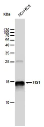 Anti-FIS1 antibody [GT12112] used in Western Blot (WB). GTX630992
