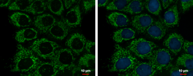Anti-ETHE1 antibody [GT1621] used in Immunocytochemistry/ Immunofluorescence (ICC/IF). GTX630994