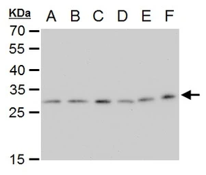Anti-ETHE1 antibody [GT1621] used in Western Blot (WB). GTX630994