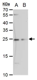 Anti-ETHE1 antibody [GT1621] used in Western Blot (WB). GTX630994