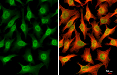 Anti-USP7 antibody [GT481] used in Immunocytochemistry/ Immunofluorescence (ICC/IF). GTX631108