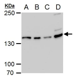 Anti-USP7 antibody [GT6512] used in Western Blot (WB). GTX631109