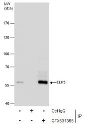 Anti-ELP3 antibody [GT11811] used in Immunoprecipitation (IP). GTX631395