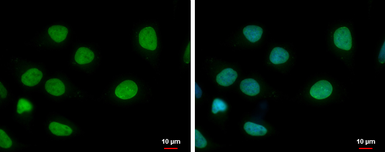 Anti-ELP3 antibody [GT11811] used in Immunocytochemistry/ Immunofluorescence (ICC/IF). GTX631395